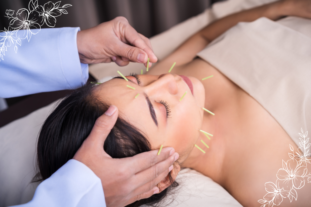 Acupuncture